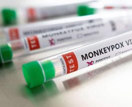 ССМ: МАЙМЫЛ ЧЕЧЕК ООРУСУ БОЮНЧА ЭПИДЕМИОЛОГИЯЛЫК АБАЛ ТУРУКТУУ